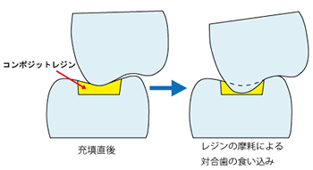 画像の説明