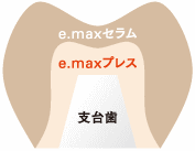 画像の説明 画像の説明