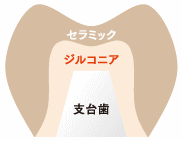 画像の説明 画像の説明